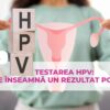Testarea HPV: ce înseamnă un rezultat pozitiv?