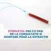 Steriletul pas cu pas: de la consultație și montare până la extracție