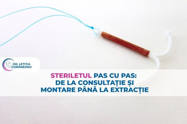 Steriletul pas cu pas: de la consultație și montare până la extracție